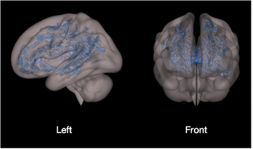 brain scan pertaining to ebook reading